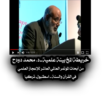 خريطة المخ بينة علمية  في تركيا